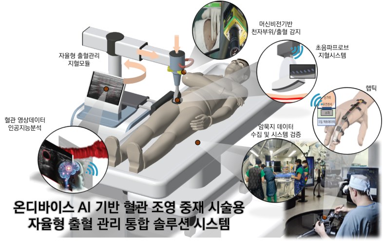 온디바이스 AI 기반 혈관 조영 중재 시술용 자율형 출혈 관리 통합 솔루션 시스템 구성도: 자율형 지혈모듈, 초음파프로브 지혈시스템, 혈관 영상데이터 인공지능분석, 햅틱 기반 암묵지 데이터 수집
